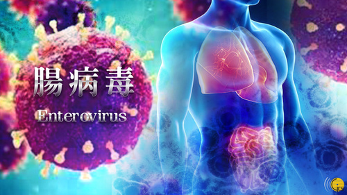 衛生局接獲1宗腸病毒群集性感染報告