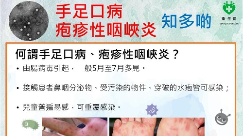 卫生局接获1宗肠病毒群集性感染报告