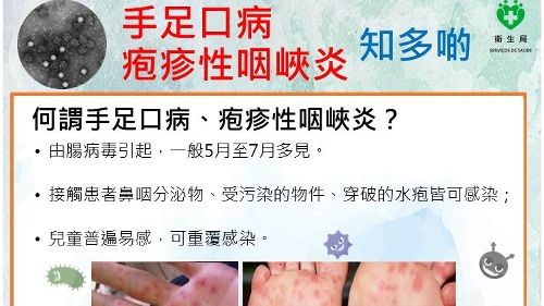 衛生局接獲1宗腸病毒群集性感染報告