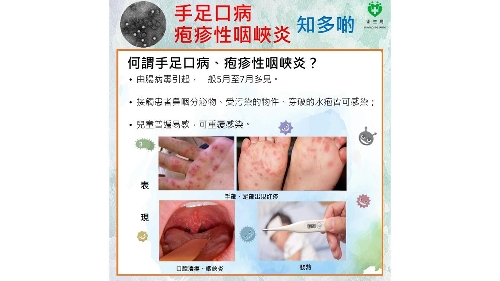衛生局接獲2宗腸病毒群集性感染報告